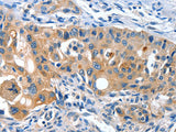 AMHR2 Polyclonal Antibody