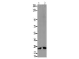 HMGB2 Polyclonal Antibody