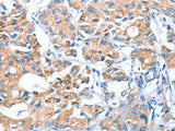 AUP1 Polyclonal Antibody Store at -20°C