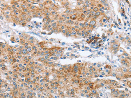 CRELD2 Polyclonal Antibody Store at -20°C