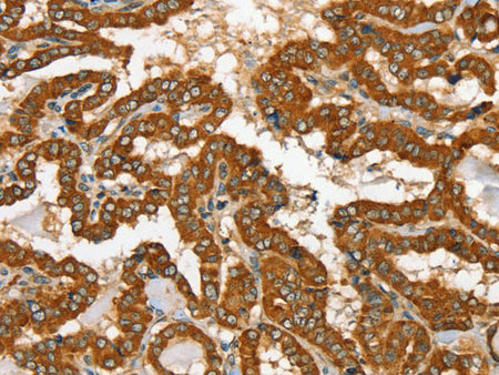 RAB25 Polyclonal Antibody Store at -20°C
