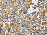 ZMYND11 Polyclonal Antibody