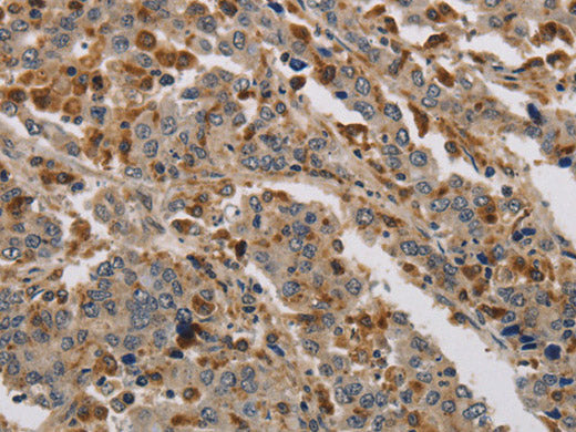 KDM4A Polyclonal Antibody Store at -20°C