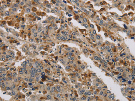 KDM4A Polyclonal Antibody Store at -20°C