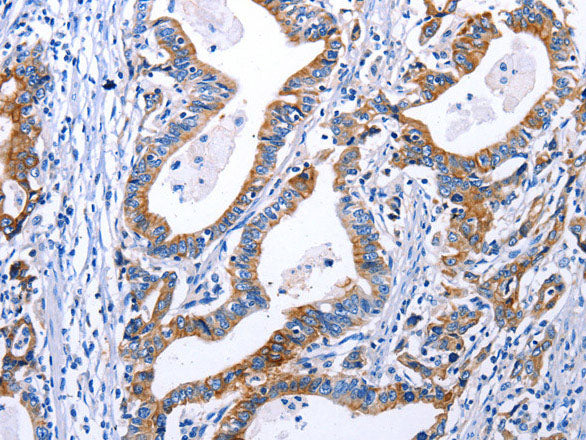 DRD4 Polyclonal Antibody Store at -20°C