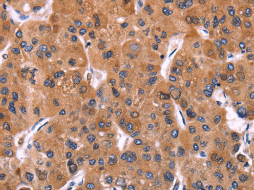 ERP29 Polyclonal Antibody