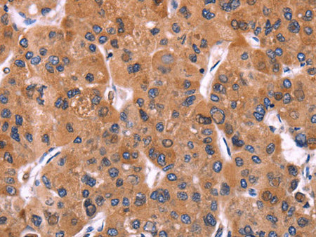 ERP29 Polyclonal Antibody