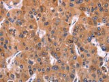 ERP29 Polyclonal Antibody