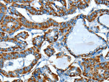 ALDH6A1 Polyclonal Antibody Store at -20°C