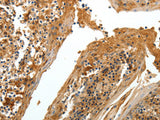 TNR Polyclonal Antibody