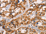 SPR Polyclonal Antibody Store at -20°C