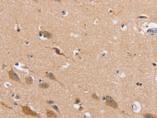 MSMB Polyclonal Antibody Store at -20°C
