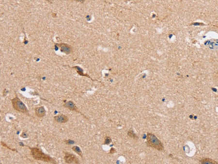 MSMB Polyclonal Antibody Store at -20°C