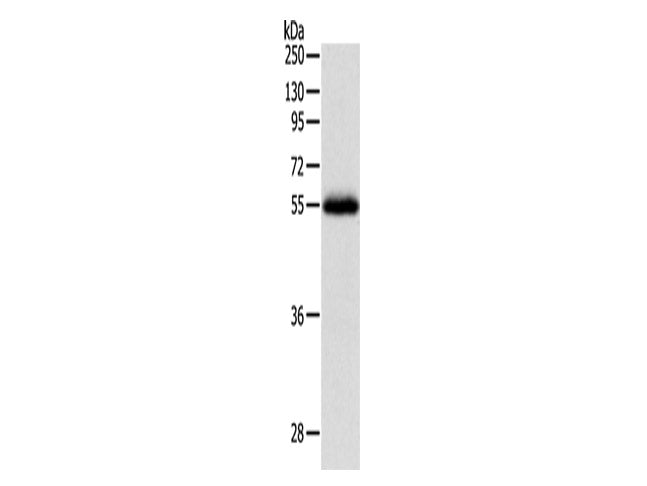 NPY1R Polyclonal Antibody Store at -20°C