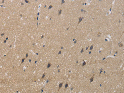 KCNMB4 Polyclonal Antibody Store at -20°C