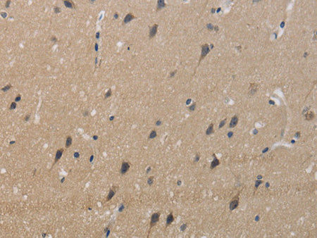 KCNMB4 Polyclonal Antibody Store at -20°C