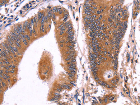 CRISP3 Polyclonal Antibody Store at -20°C