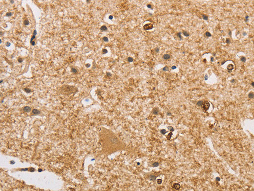 ARHGEF5 Polyclonal Antibody Store at -20°C