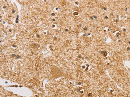 ARHGEF5 Polyclonal Antibody Store at -20°C