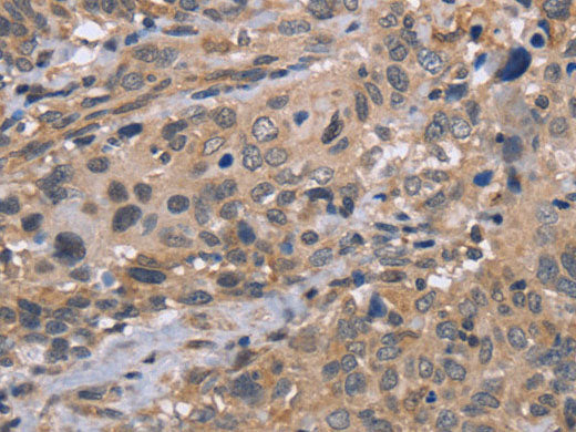 EDA Polyclonal Antibody Store at -20°C