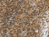 FOXB1 Polyclonal Antibody Store at -20°C