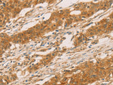 SLC6A3 Polyclonal Antibody Store at -20°C