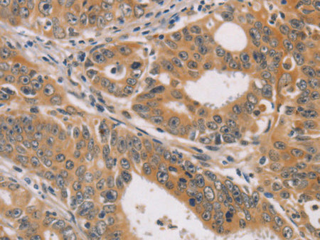 CDK11B Polyclonal Antibody Store at -20°C