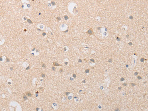 ATG9A Polyclonal Antibody Store at -20°C