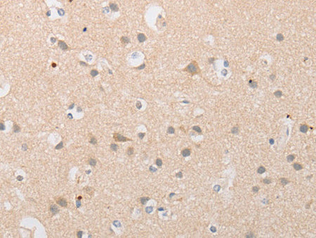 ATG9A Polyclonal Antibody Store at -20°C