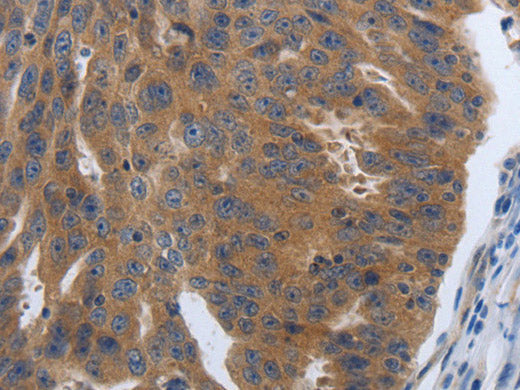 PDGFA Polyclonal Antibody Store at -20°C
