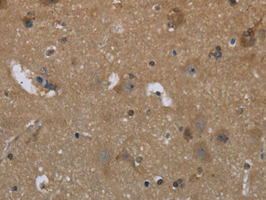 GYS2 Polyclonal Antibody Store at -20°C