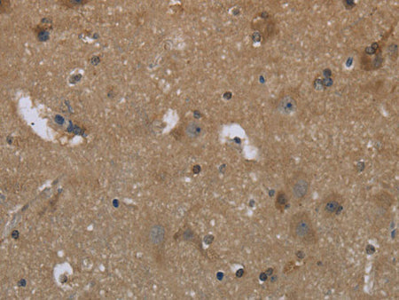 GYS2 Polyclonal Antibody Store at -20°C