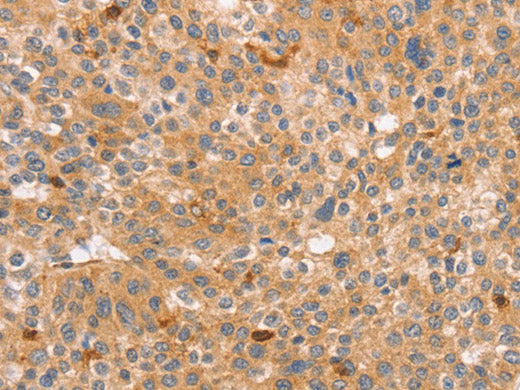 CCL16 Polyclonal Antibody Store at -20°C