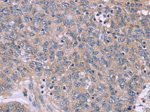 IL3RB Polyclonal Antibody
