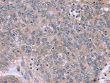 IL3RB Polyclonal Antibody