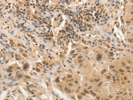 ADAR Polyclonal Antibody Store at -20°C