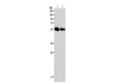 MMP11 Polyclonal Antibody Store at -20°C