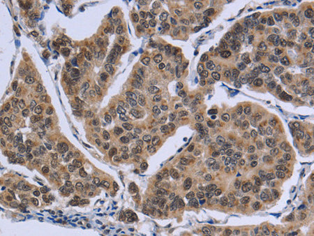 IPO8 Polyclonal Antibody Store at -20°C