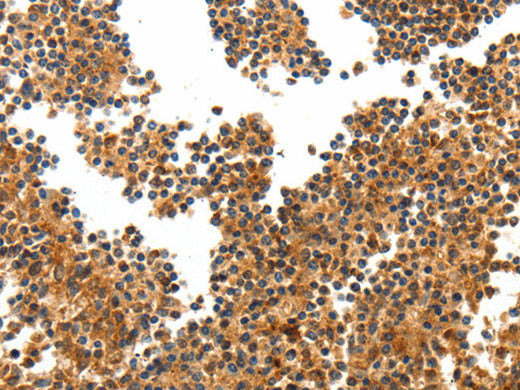 TERT Polyclonal Antibody Store at -20°C