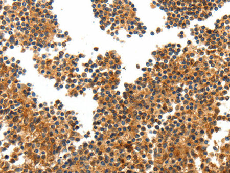 TERT Polyclonal Antibody Store at -20°C