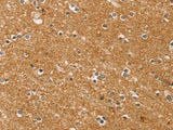 SYTL5 Polyclonal Antibody