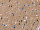 KCNJ11 Polyclonal Antibody Store at -20°C