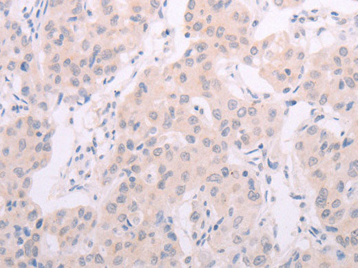 TSHR Polyclonal Antibody Store at -20°C