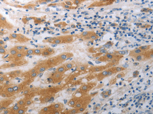 SLC12A6 Polyclonal Antibody Store at -20°C