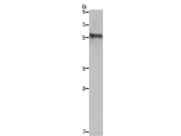 FKBP8 Polyclonal Antibody Store at -20°C
