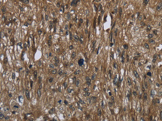 FASTKD2 Polyclonal Antibody Store at -20°C