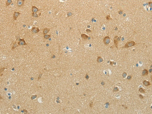NDRG3 Polyclonal Antibody Store at -20°C