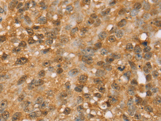 MED22 Polyclonal Antibody Store at -20°C
