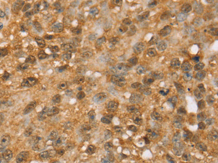 MED22 Polyclonal Antibody Store at -20°C