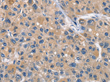 CLEC2D Polyclonal Antibody Store at -20°C